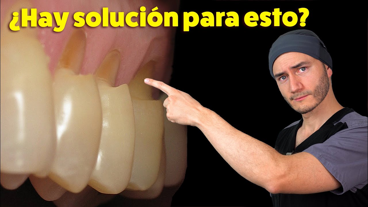 Dentista Seguridad Social Pamplona